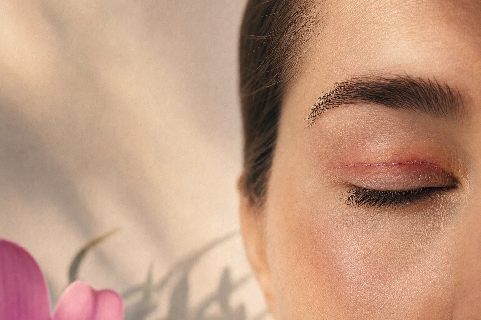 Blépharoplastie : évolution des cicatrices en 2026